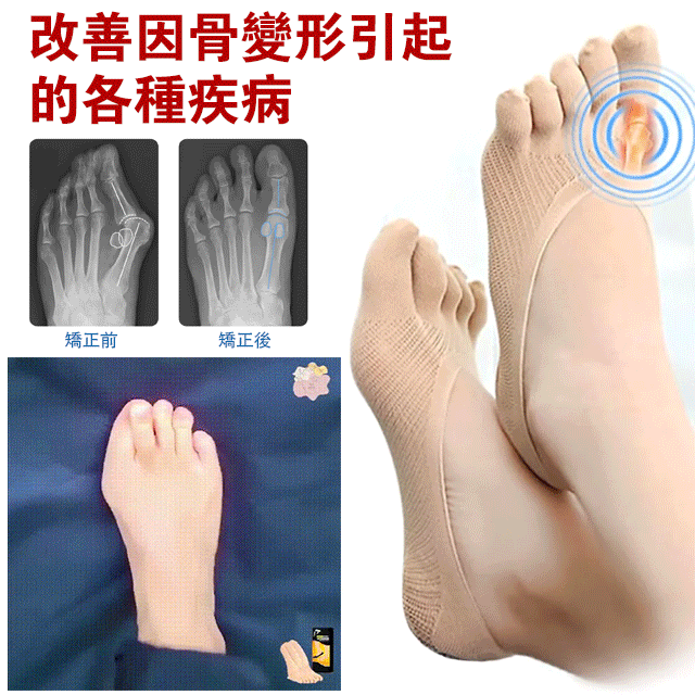 買六送六 消腫緩痛五指襪  免運費 七天鑑賞期 